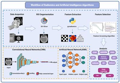 Advances in research and application of artificial intelligence and radiomic predictive models based on intracranial aneurysm images